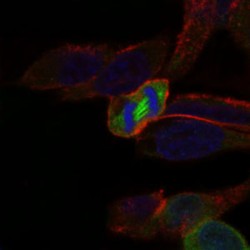 Serine/threonine-Protein Kinase PLK1 (PLK1) Antibody
