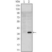 Western blot analysis using SLC22A1 antibody against HEK293 (1) and SLC22A1 (AA: 284-347) -hIgGFc transfected HEK293 (2) cell lysate.