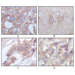 Tyrosine-Protein Kinase STYK1 (STYK1) Antibody