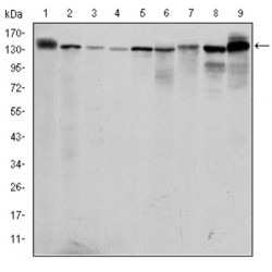 Serine/Threonine-Protein Kinase N2 (PKN2) Antibody