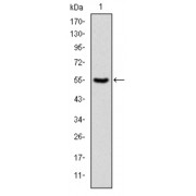 Western blot analysis using PRK2 antibody against human PRK2 (AA: 555-718) recombinant protein. (Expected MW is 43.9 kDa).