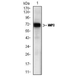 Matrix Metalloproteinase 2 (MMP2) Antibody