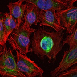 Interstitial Collagenase (MMP1) Antibody