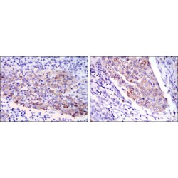 Interstitial Collagenase (MMP1) Antibody