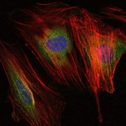 Matrix Metalloproteinase-9 (MMP9) Antibody