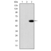 abx011408