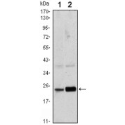 Western blot analysis using Rab10 antibody against Hela (1) and NIH/3T3 (2) cell lysate.