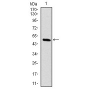 Western blot analysis using RAF1 antibody against human RAF1 (AA: 198-407) recombinant protein. (Expected MW is 73 kDa).