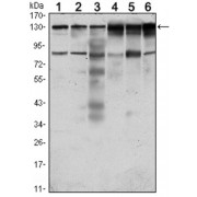Western blot analysis using PTK7 antibody against Hela (1), A431 (2), HCT116 (3), Caco2 (4), HepG2 (5) and MCF-7 (6) cell lysate.