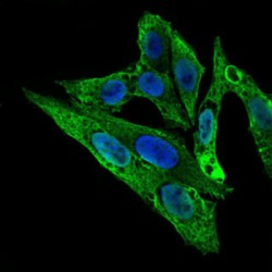 Rho GDP-Dissociation Inhibitor 1 (ARHGDIA) Antibody