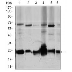 Rho GDP-Dissociation Inhibitor 1 (ARHGDIA) Antibody
