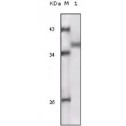 Western blot analysis using RSK1 antibody against truncated RSK1 recombinant protein.