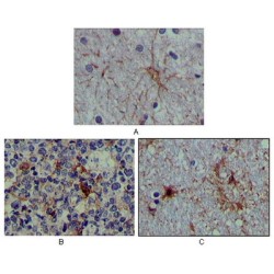 Protein S100-A1 (S100A1) Antibody
