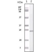 Western blot analysis using S100A antibody against truncated S100A recombinant protein.