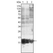 Western blot analysis using S100A10/P11 antibody against MCF-7 (1), HepG2 (2) and Hela (3).