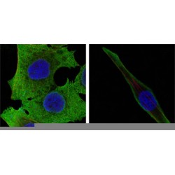 Superoxide Dismutase 1 (SOD1) Antibody