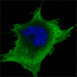 Superoxide Dismutase 1 (SOD1) Antibody