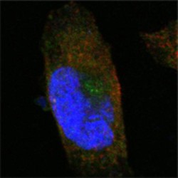 Sortilin Related Receptor (SORL1) Antibody