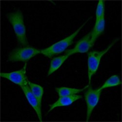 Hsc70-Interacting Protein (ST13) Antibody