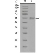 Western blot analysis using SYT1 antibody against truncated Trx-SYT1 recombinant protein (1).