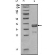 Western blot analysis using ABL1 antibody against truncated GST-ABL1 recombinant protein (1).