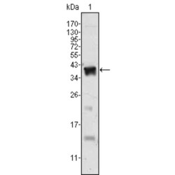 Androgen Receptor (AR) Antibody