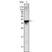 Western blot analysis using Androgen receptor antibody against K562 (1), Jurkat (2) and LNCaP (3) cell lysate.
