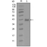 Western blot analysis using AR antibody against truncated Trx-AR recombinant protein (1).