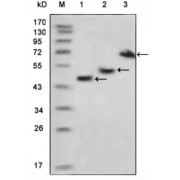 Western blot analysis using MBP antibody against various fusion protein with MBP tag.
