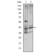 Western blot analysis using CST3 antibody against Hela (1) and Caco-2 (2) cell lysate.