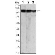 Western blot analysis using HK2 antibody against Jurkat (1), Hela (2) and HEK293 (3) cell lysate.