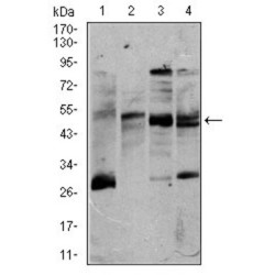 T-Cell Surface Glycoprotein CD5 (CD5) Antibody