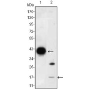 Western blot analysis using FABP2 antibody against FABP2-hIgGFc transfected HEK293 (1) cell lysate and LOVO (2) cell lysate.