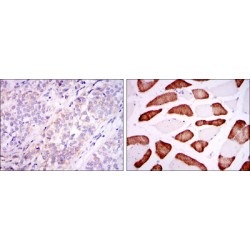 Broad Substrate Specificity ATP-Binding Cassette Transporter ABCG2 (ABCG2) Antibody