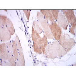 Interleukin 1 Beta (IL1B) Antibody