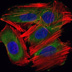 SUMO-Conjugating Enzyme UBC9 (UBE2I) Antibody