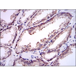 SUMO-Conjugating Enzyme UBC9 (UBE2I) Antibody