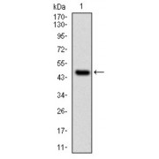 Western blot analysis using UBE2I antibody against human UBE2I (AA: 1-158) recombinant protein. (Expected MW is 45.3 kDa).