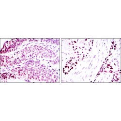 p63 alpha Antibody