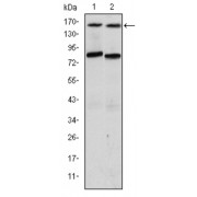 Western blot analysis using AIB1 antibody against T47D (1) and MCF-7 (2) cell lysate.