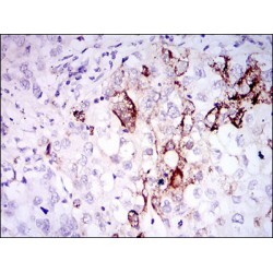 Somatostatin (SST) Antibody