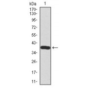 Western blot analysis using SST antibody against human SST recombinant protein. (Expected MW is 38.2 kDa).