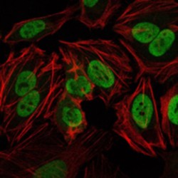 DNA-Dependent Protein Kinase Catalytic Subunit (PRKDC) Antibody