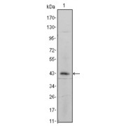 Western blot analysis using ITGA5 antibody against ITGA5-hIgGFc transfected HEK293 cell lysate.