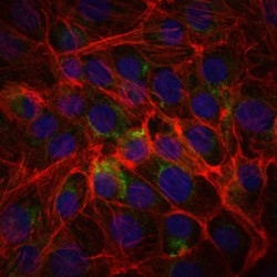 Alpha-(1,3)-Fucosyltransferase 4 (FUT4) Antibody