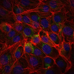 Alpha-(1,3)-Fucosyltransferase 4 (FUT4) Antibody