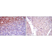 Immunohistochemical analysis of paraffin-embedded human cerebellum tissues (left) and human liver cancer tissues (right) using CD15 antibody with DAB staining.