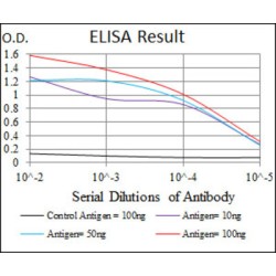 C-Reactive Protein (CRP) Antibody