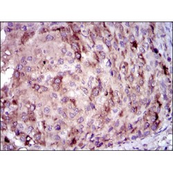 C-Reactive Protein (CRP) Antibody