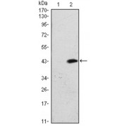 Western blot analysis using ATM antibody against HEK293 (1) and ATM (AA: 2705-2820) -hIgGFc transfected HEK293 (2) cell lysate.